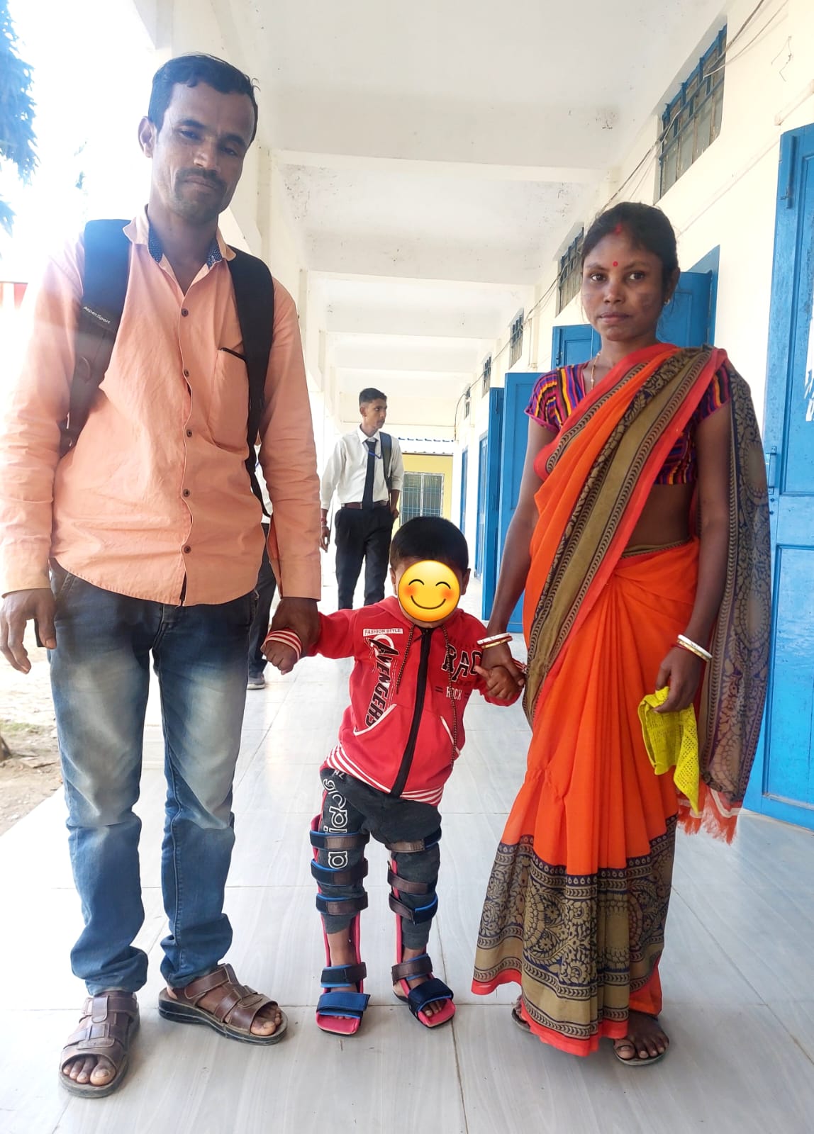 Read more about the article Diagnosed for Club Foot the child was provided with artificial support system for his legs